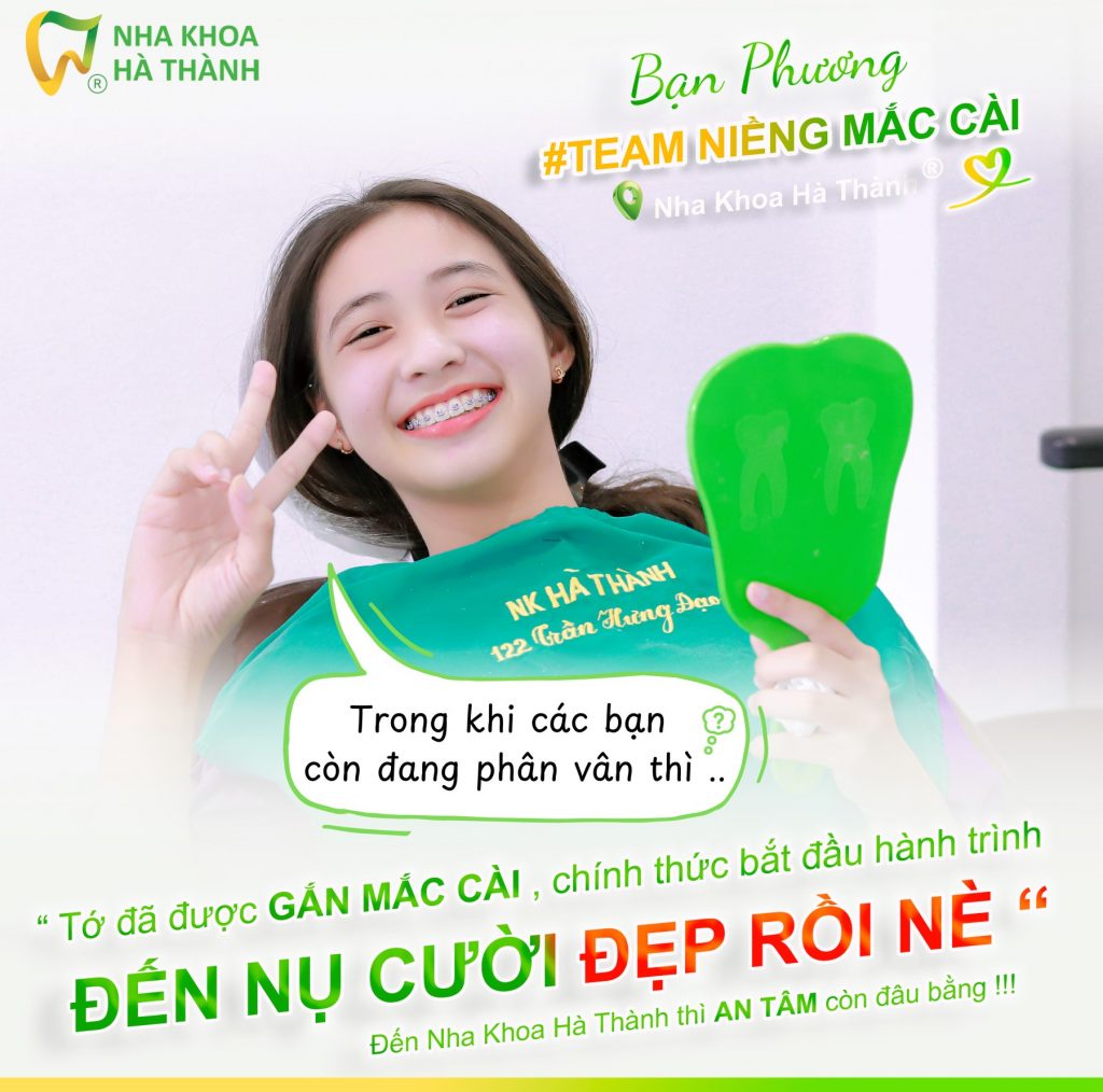 niềng răng mắc cài kim loại
